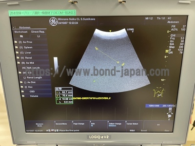 Color Doppler&nbsp;|&nbsp;GE&nbsp;|&nbsp;LOGIQ e V2