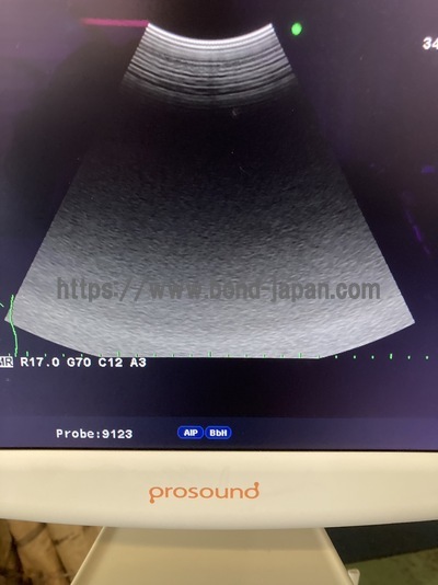 Color Doppler&nbsp;|&nbsp;HITACHI&nbsp;|&nbsp;Prosound α6