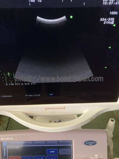 Color Doppler&nbsp;|&nbsp;HITACHI&nbsp;|&nbsp;Prosound α6