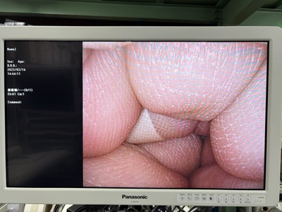 内視鏡セットVISERA ELITE&nbsp;|&nbsp;オリンパス&nbsp;|&nbsp;OTV-S190/CLV-S190の写真