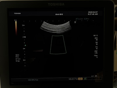 Color Doppler&nbsp;|&nbsp;CANON&nbsp;|&nbsp;SSA-660A Xario
