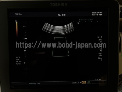 Color Doppler&nbsp;|&nbsp;CANON&nbsp;|&nbsp;SSA-660A Xario