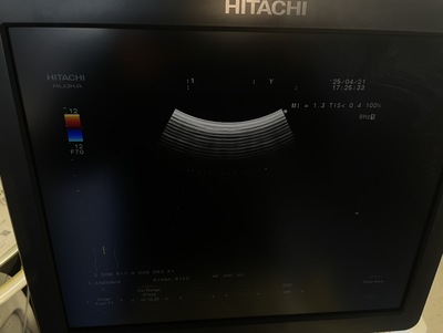 Color Doppler&nbsp;|&nbsp;HITACHI&nbsp;|&nbsp;F37