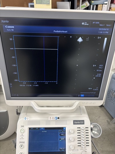 Color Doppler&nbsp;|&nbsp;CANON&nbsp;|&nbsp;TUS-X100 Xario 100
