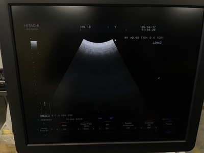 Color Doppler&nbsp;|&nbsp;HITACHI&nbsp;|&nbsp;F37