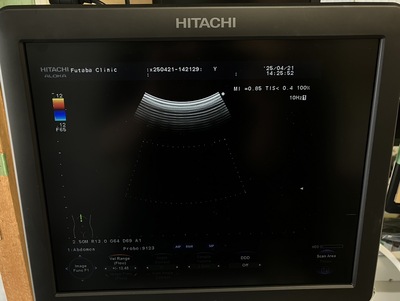 Color Doppler&nbsp;|&nbsp;HITACHI&nbsp;|&nbsp;F37