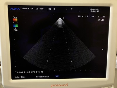 Ultrasound System&nbsp;|&nbsp;HITACHI&nbsp;|&nbsp;Prosound α7