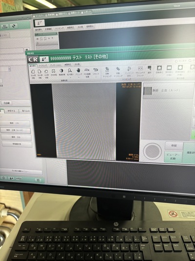 CR System&nbsp;|&nbsp;FUJIFILM&nbsp;|&nbsp;FCR PRIMA T2