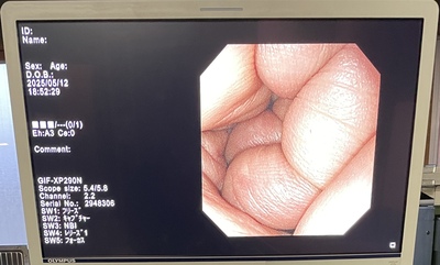 Endoscopy System&nbsp;|&nbsp;OLYMPUS&nbsp;|&nbsp;LUCERA ELITE CV-290