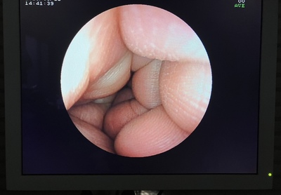 Endoscopy System&nbsp;|&nbsp;FUJIFILM&nbsp;|&nbsp;EPX-3000