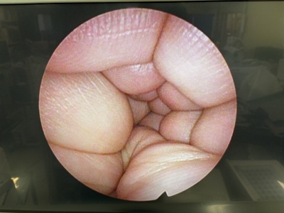 Endoscope Camera Head&nbsp;|&nbsp;OLYMPUS&nbsp;|&nbsp;OTV-S7H-1N