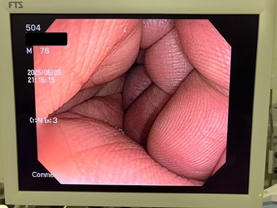 Endoscopy System&nbsp;|&nbsp;OLYMPUS&nbsp;|&nbsp;CV-150