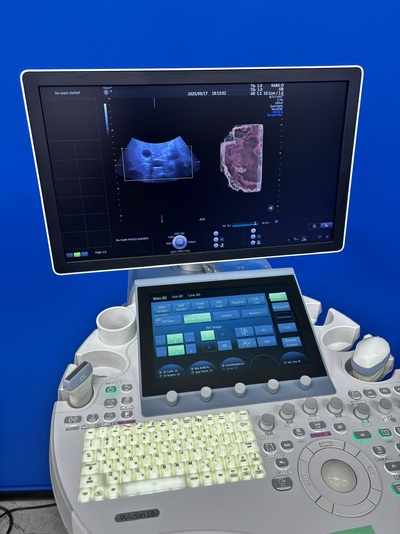 4D Ultrasound&nbsp;|&nbsp;GE&nbsp;|&nbsp;Voluson E8 BT15
