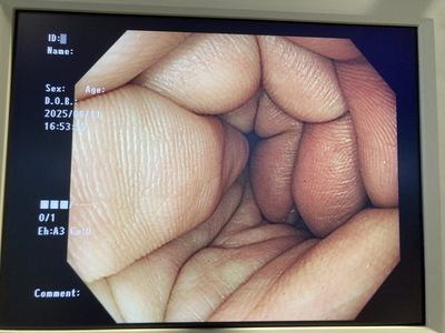 Video Colonoscope&nbsp;|&nbsp;OLYMPUS&nbsp;|&nbsp;PCF-H290I