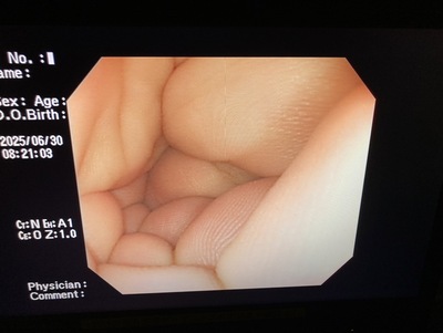 Video Colonoscope&nbsp;|&nbsp;OLYMPUS&nbsp;|&nbsp;PCF-Q260AZI