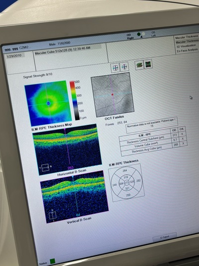 OCT&nbsp;|&nbsp;Carl Zeiss&nbsp;|&nbsp;Cirrus 500 HD-OCT Plus
