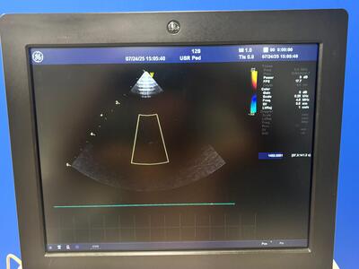Ultrasound&nbsp;|&nbsp;GE&nbsp;|&nbsp;Vivid E9