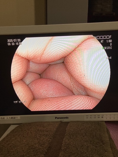 Colonoscope&nbsp;|&nbsp;FUJIFILM&nbsp;|&nbsp;EC-L600ZP7