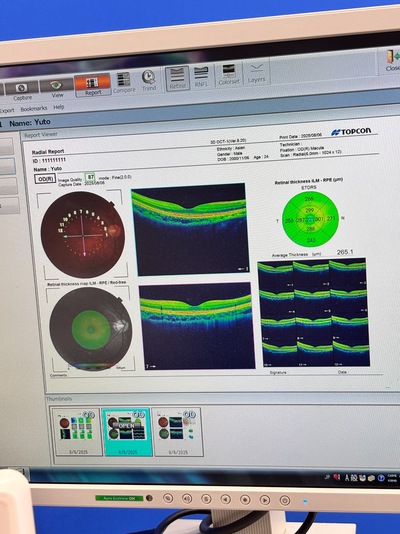 OCT with Non-mydriatic retinal camera&nbsp;|&nbsp;TOPCON&nbsp;|&nbsp;3D OCT 1 / Maestro 1