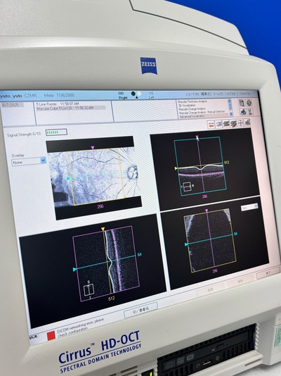 OCT&nbsp;|&nbsp;Carl Zeiss&nbsp;|&nbsp;Cirrus 400 HD-OCT