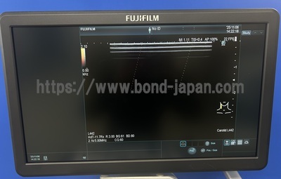 超音波診断装置/カラードプラ&nbsp;|&nbsp;富士フイルムヘルスケア&nbsp;|&nbsp;ARIETTA 65LELVの写真