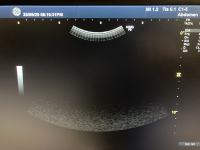 Ultrasound&nbsp;|&nbsp;GE&nbsp;|&nbsp;LOGIQ P9