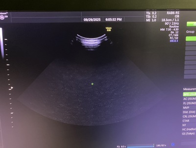 4D Ultrasound&nbsp;|&nbsp;GE&nbsp;|&nbsp;Voluson S10 BT16