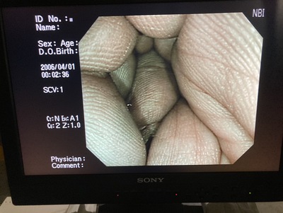 Endoscopy System&nbsp;|&nbsp;OLYMPUS&nbsp;|&nbsp;LUCERA CV-260SL