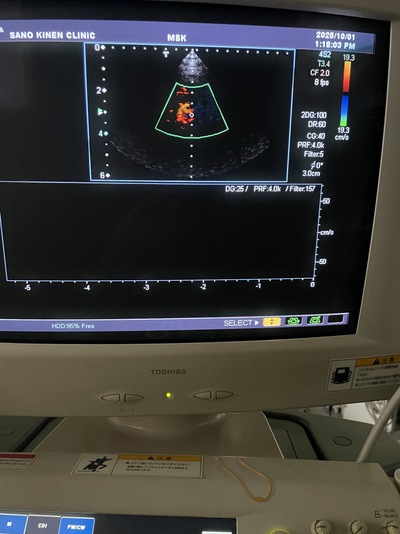 Ultrasound Color Doppler&nbsp;|&nbsp;CANON&nbsp;|&nbsp;SSA-700A Aplio50