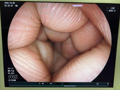 Endoscopy System&nbsp;|&nbsp;FUJIFILM&nbsp;|&nbsp;EPX-4450HD