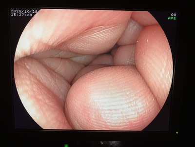 Video Gastroscope&nbsp;|&nbsp;FUJIFILM&nbsp;|&nbsp;EG-3000FP