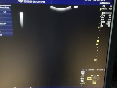 Color Doppler&nbsp;|&nbsp;GE&nbsp;|&nbsp;Logiq S7 Expert