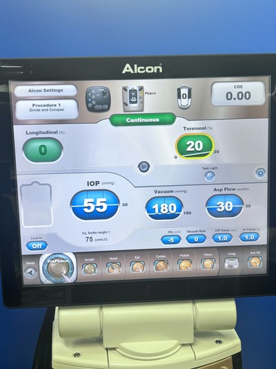 Phacoemulsification, cataract surgery machine&nbsp;|&nbsp;Alcon&nbsp;|&nbsp;Centurion Vision System