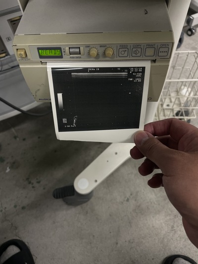 Ultrasound&nbsp;|&nbsp;HITACHI&nbsp;|&nbsp;Prosound 2