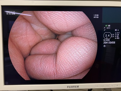 Endoscope System&nbsp;|&nbsp;FUJIFILM&nbsp;|&nbsp;EP-6000