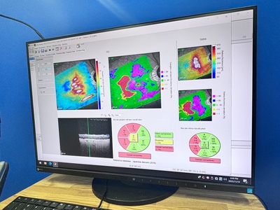 OCT&nbsp;|&nbsp;Heidelberg Engineering GmbH&nbsp;|&nbsp;SPECTRALIS OCT2