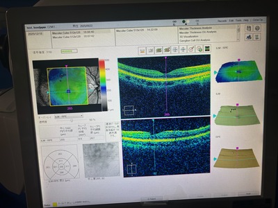 Zeiss OCT&nbsp;|&nbsp;Carl Zeiss&nbsp;|&nbsp;Cirrus 500 HD-OCT Plus