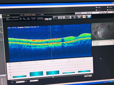 Optical Coherence Tomography・OCT&nbsp;|&nbsp;NIDEK&nbsp;|&nbsp;RS-3000 Advance