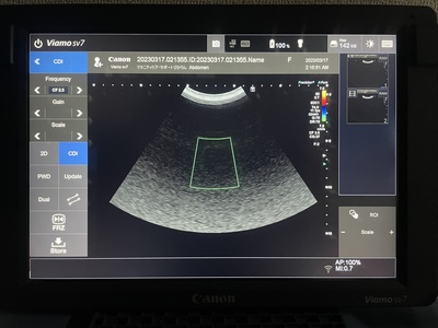 Ultrasound System&nbsp;|&nbsp;CANON&nbsp;|&nbsp;CUS-VSV7