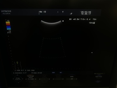 Color Doppler&nbsp;|&nbsp;HITACHI&nbsp;|&nbsp;F37