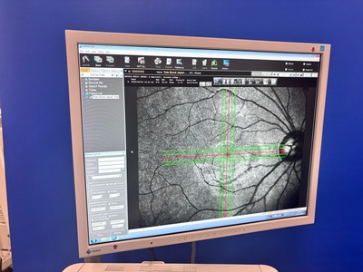 OCT with Fundus function&nbsp;|&nbsp;NIDEK&nbsp;|&nbsp;RS-3000 Advance