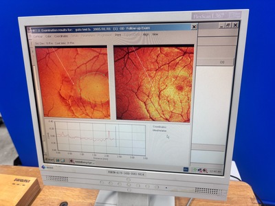 Retina Topo&nbsp;|&nbsp;Heidelberg Engineering GmbH&nbsp;|&nbsp;Retina Tomograph 2 HRT II