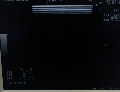 BW System&nbsp;|&nbsp;ALOKA&nbsp;|&nbsp;Prosound 6