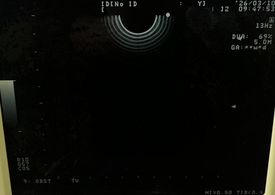 BW System&nbsp;|&nbsp;ALOKA&nbsp;|&nbsp;Prosound 6