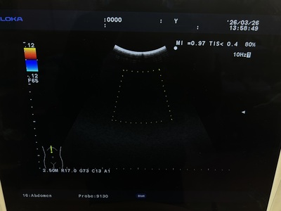 Ultrasound System&nbsp;|&nbsp;HITACHI&nbsp;|&nbsp;Prosound α7