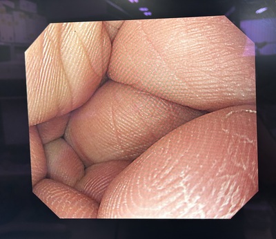 Endoscopy System&nbsp;|&nbsp;OLYMPUS&nbsp;|&nbsp;LUCERA ELITE CV-290