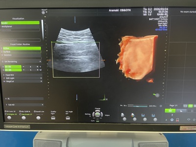 &nbsp;|&nbsp;GE&nbsp;|&nbsp;Voluson S8 BT18