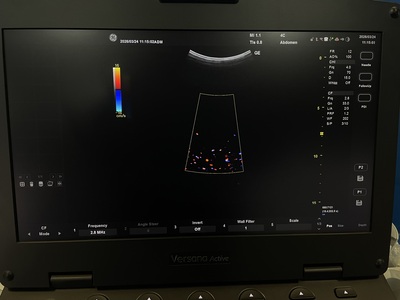 Portable Color doppler&nbsp;|&nbsp;GE&nbsp;|&nbsp;Versana Active