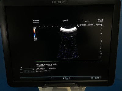 &nbsp;|&nbsp;Fujifilm&nbsp;|&nbsp;ARIETTA 70