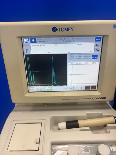 A, B, UBM Scanner&nbsp;|&nbsp;TOMEY&nbsp;|&nbsp;UD-6000